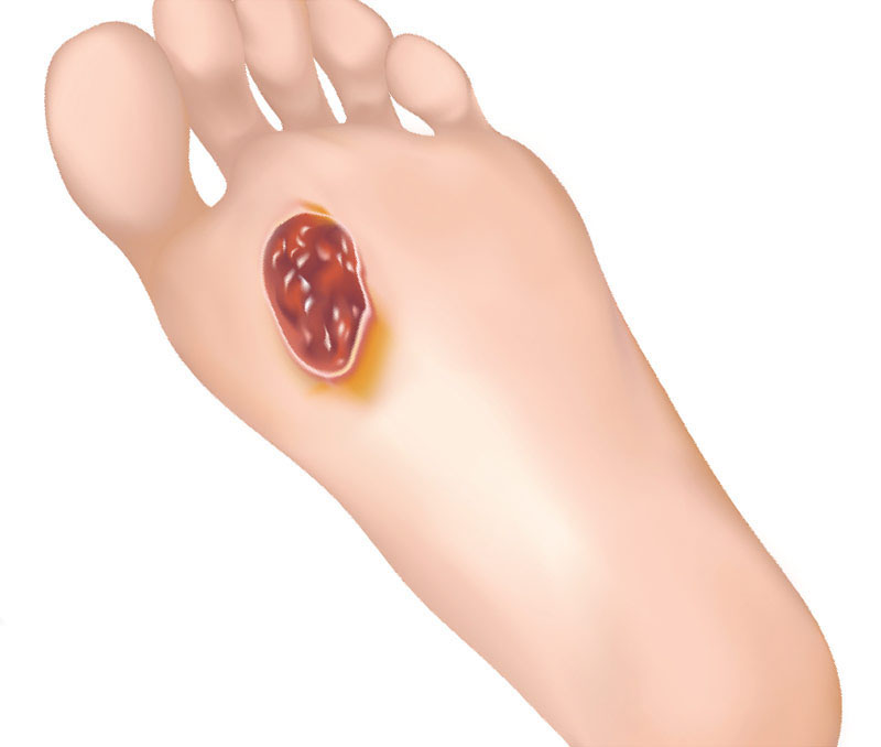 Pieds