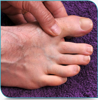 Inspection des pieds et des orteils