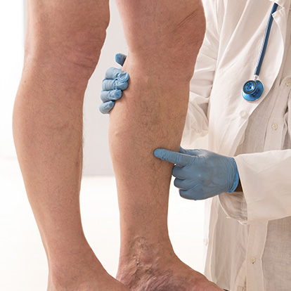 Examen des 2 jambes et des hanches
