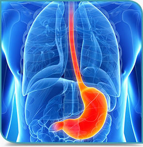 Reflux gastro-œsophagien