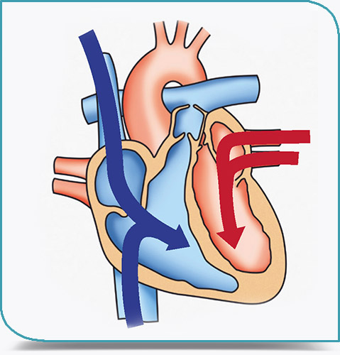 Diastole