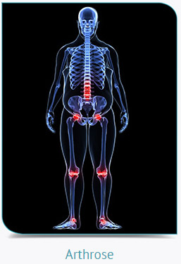 Articulations