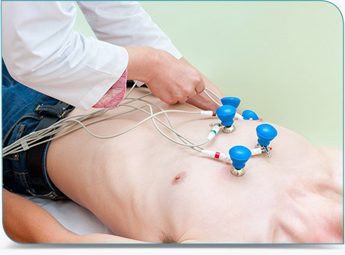 Electrocardiogramme