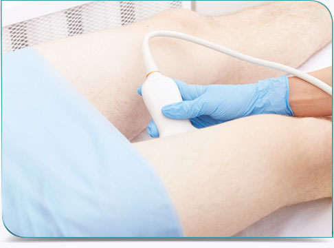 Echographie - doppler