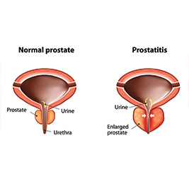 Prostate