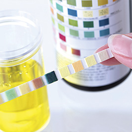Echantillon d’urine
