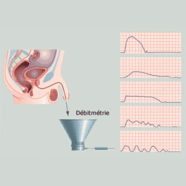 Débitmétrie