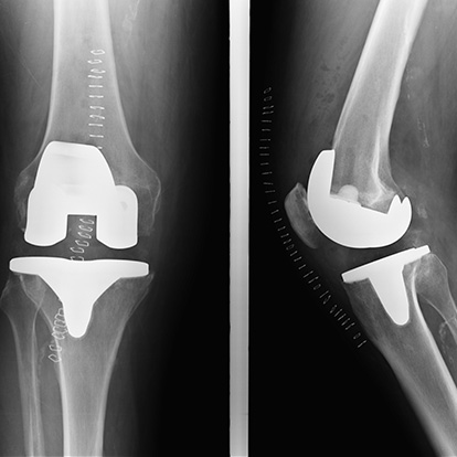 Contrôle radiographique
