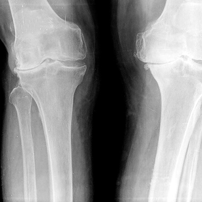 Radiographie