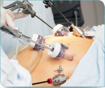 Chirurgie