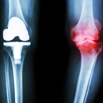Contrôle post-chirurgical