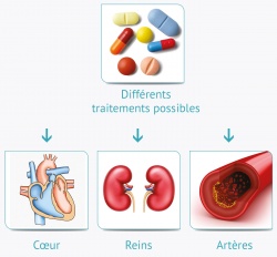Médicaments